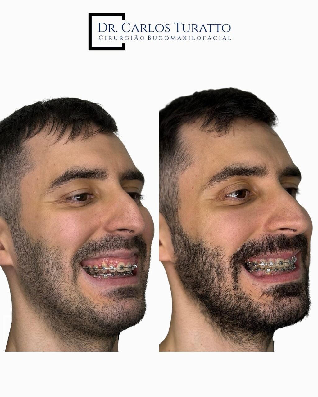 Instagram post from carlosturatto. This post is in position 5.