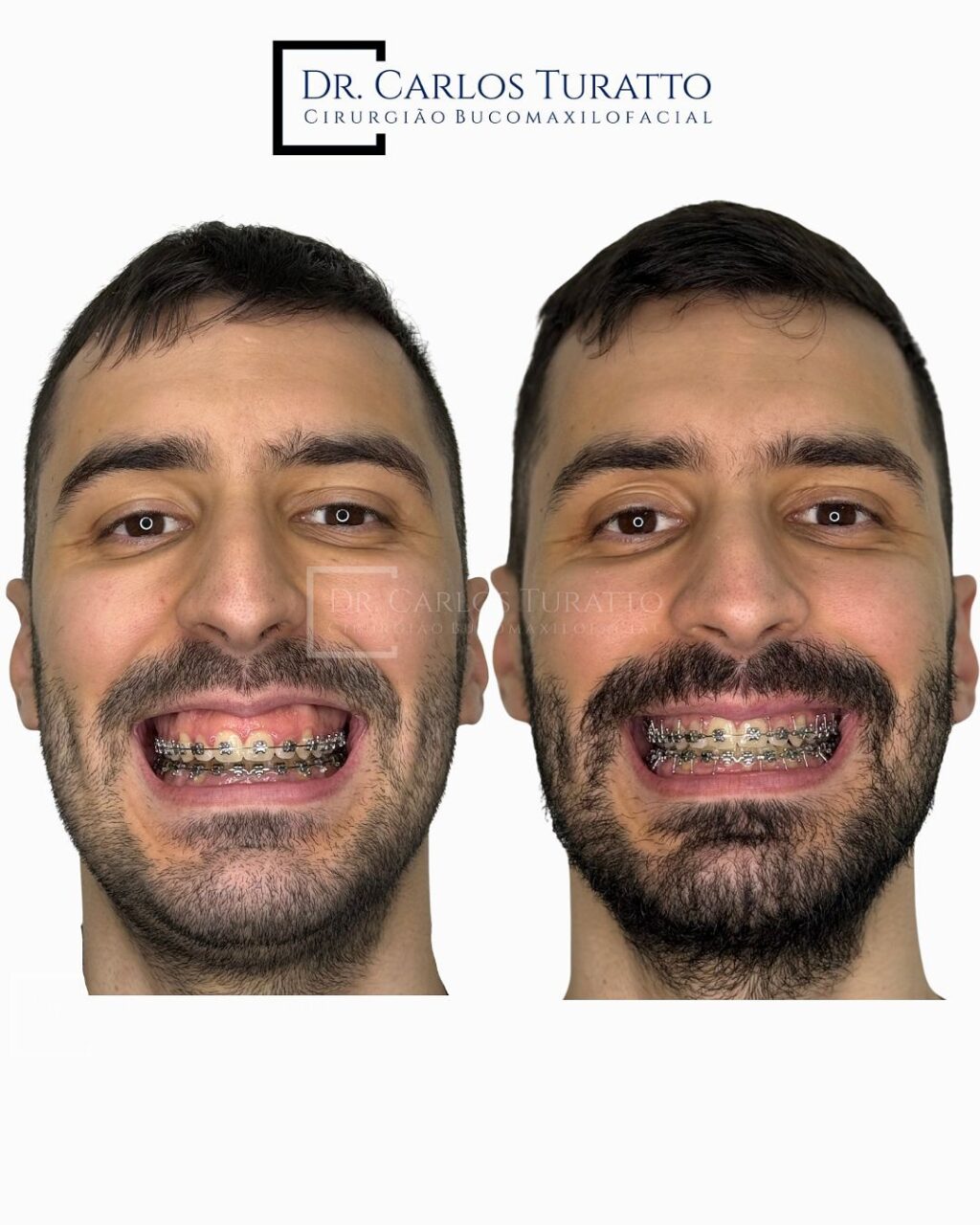 Instagram post from carlosturatto. This post is in position 0.