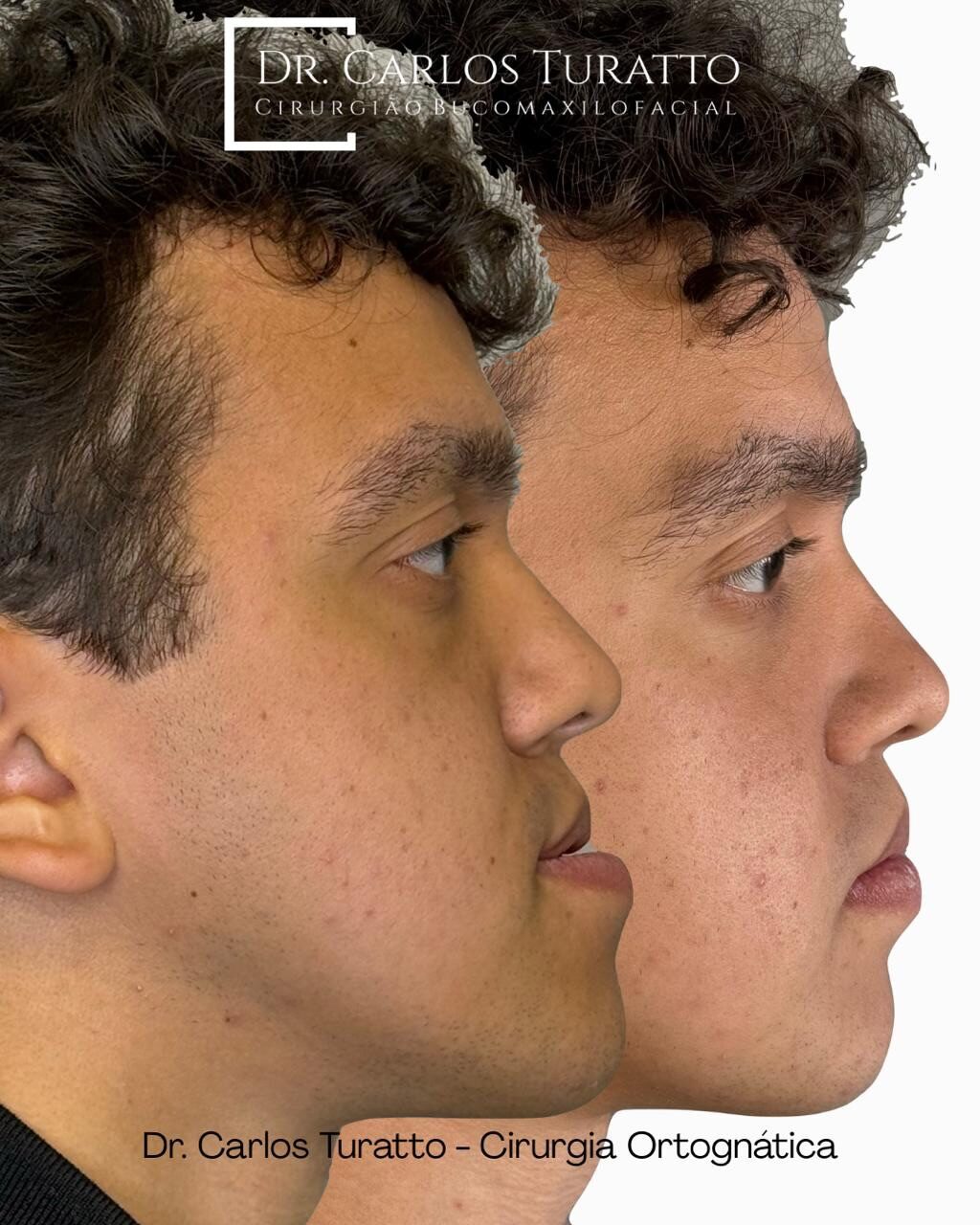 Instagram post from carlosturatto. This post is in position 0.