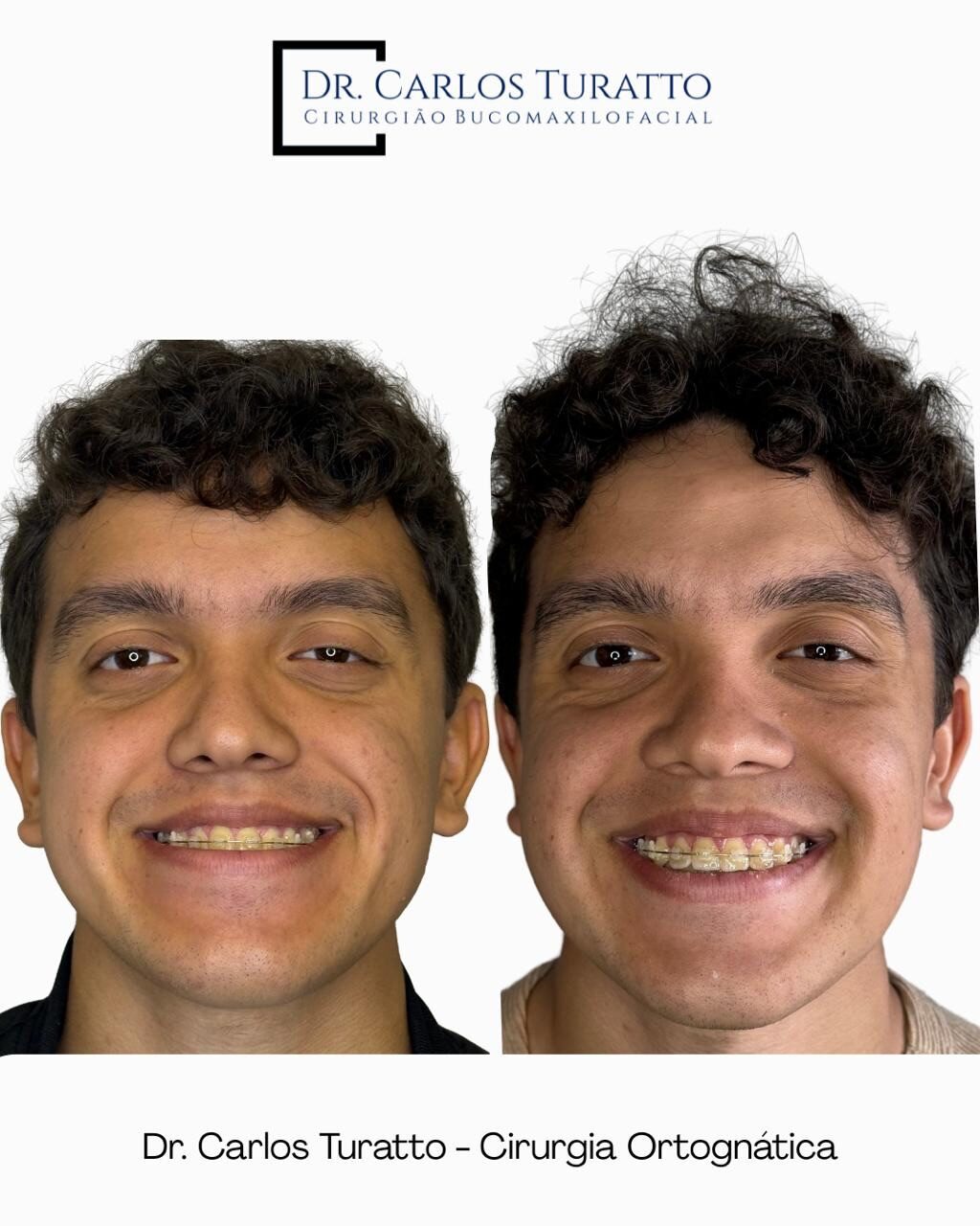 Instagram post from carlosturatto. This post is in position 6.