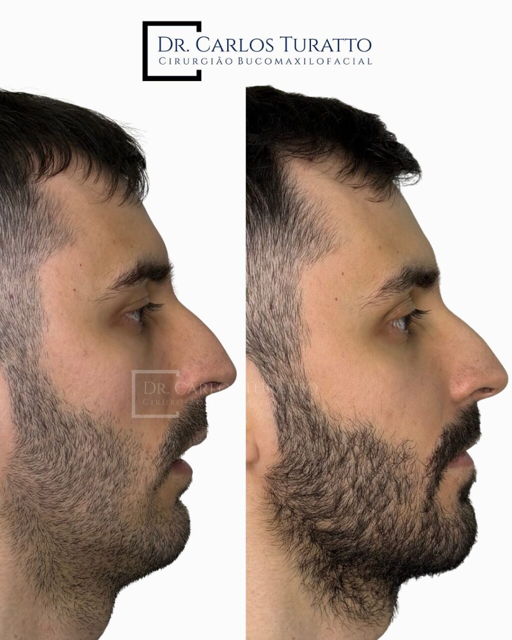 Instagram post from carlosturatto. This post is in position 2.