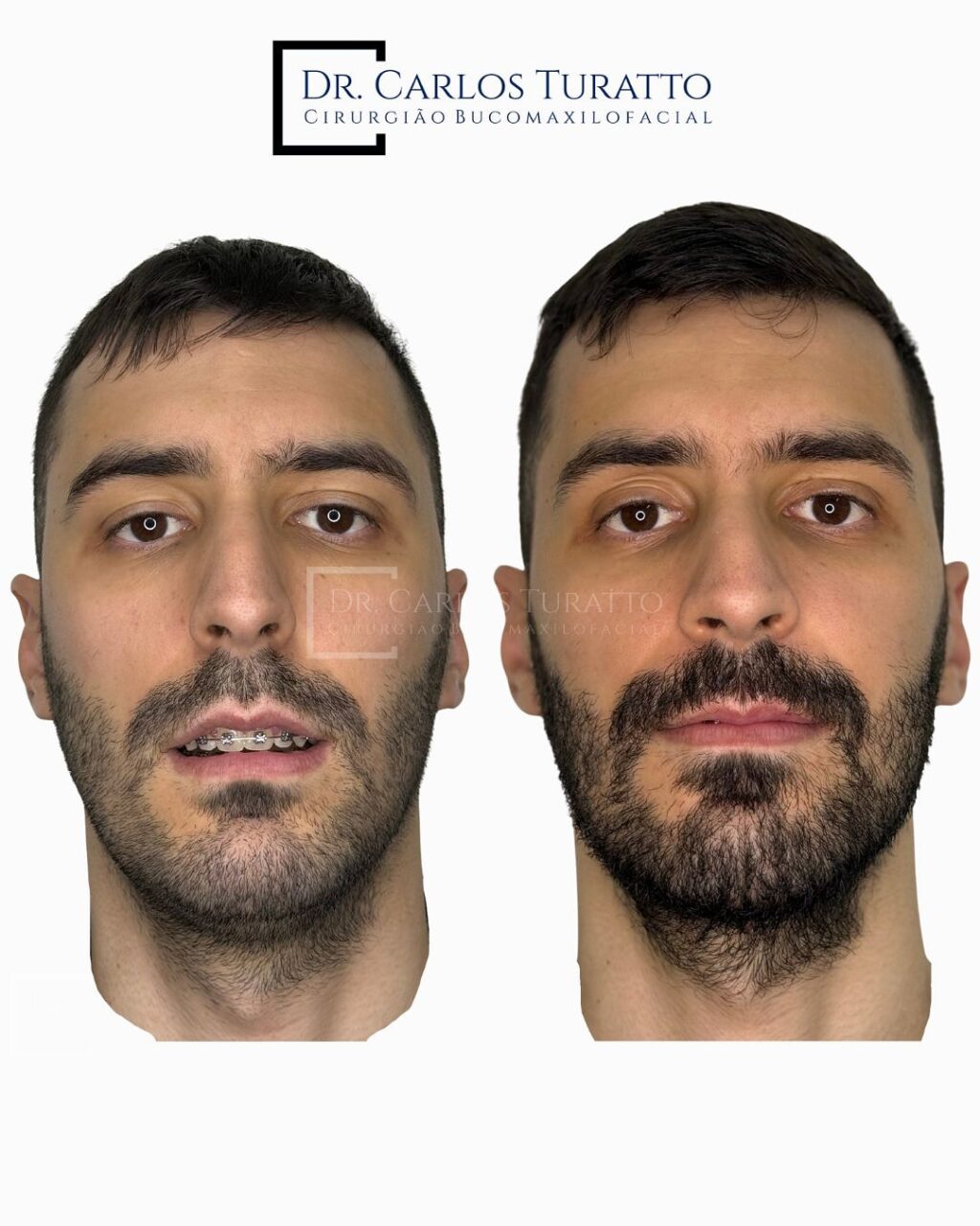 Instagram post from carlosturatto. This post is in position 1.