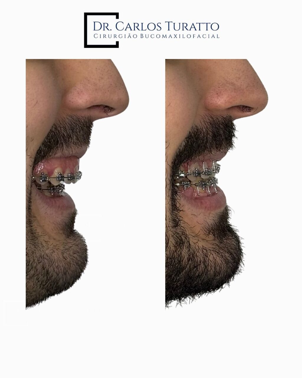 Instagram post from carlosturatto. This post is in position 6.