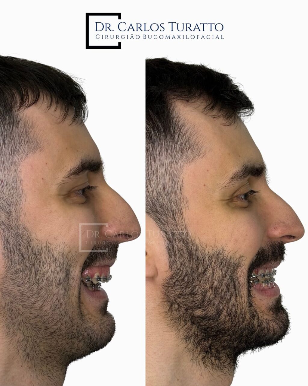 Instagram post from carlosturatto. This post is in position 3.