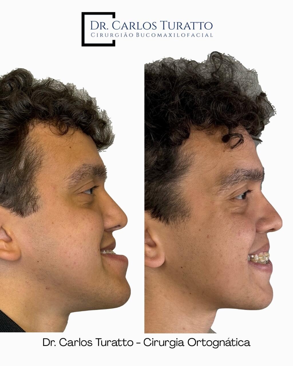 Instagram post from carlosturatto. This post is in position 2.