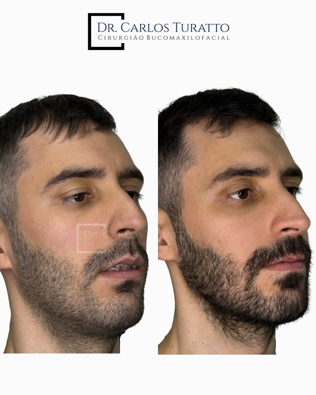 Instagram post from carlosturatto. This post is in position 4.