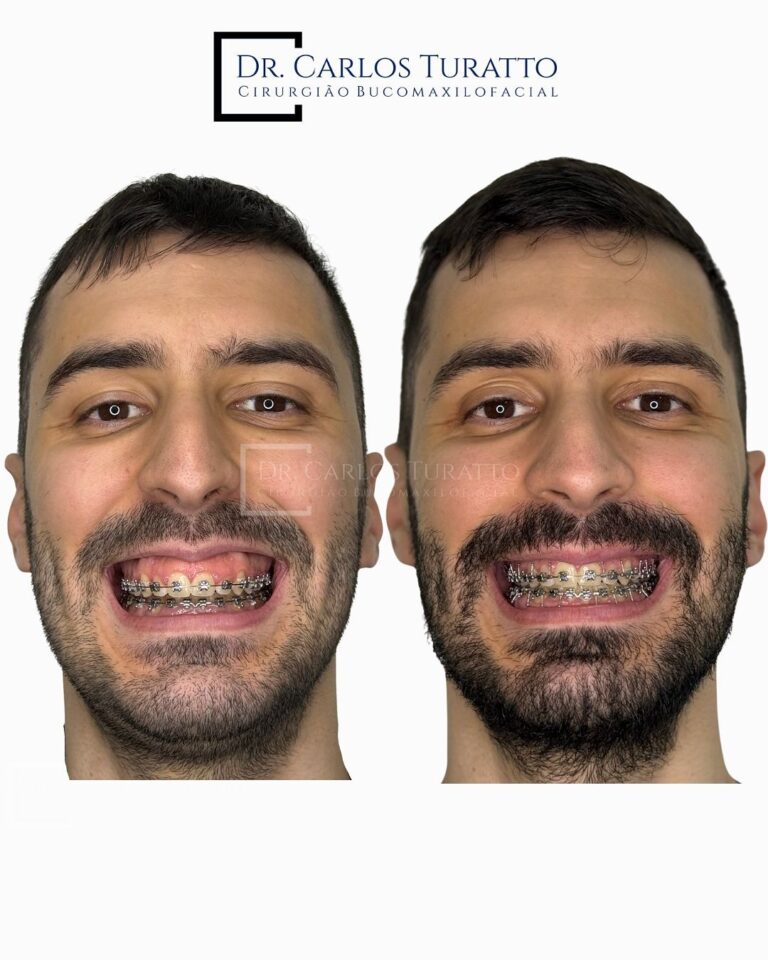 Instagram post from carlosturatto. This post is in position 1.